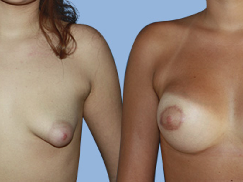 Фото женских сосков груди