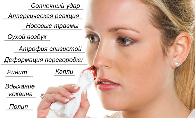 причины крови из носа