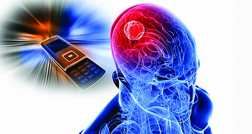 мозг и мобильный телефон