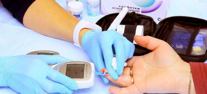 Лечение инсульта при сахарном диабете