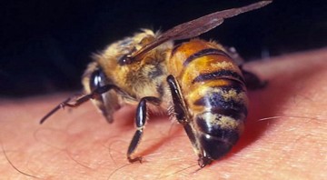 Лечение варикоза пчелами: особенности проведения процедуры