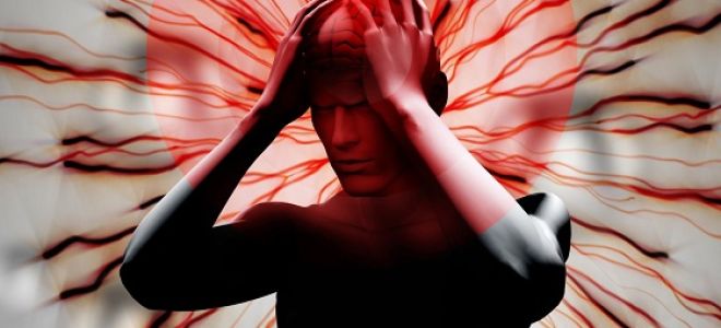 Причины и лечение невралгии головы
