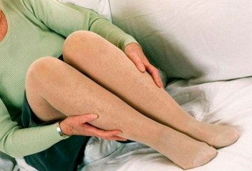 Безоперационное лечение варикоза на ногах народными средствами