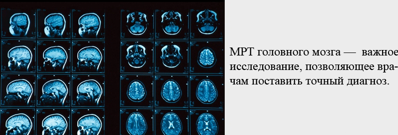 Как проходить МРТ головного мозга с контрастом?