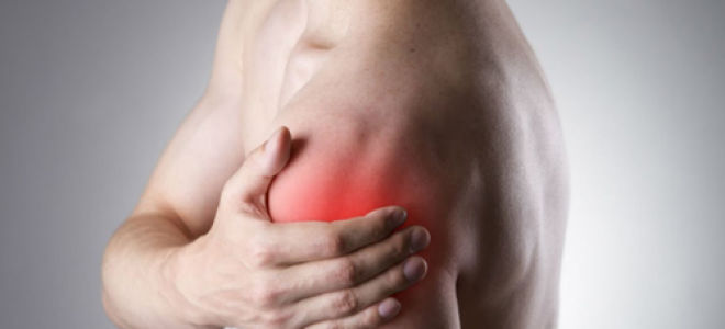 Причины и лечение неврита плечевого нерва
