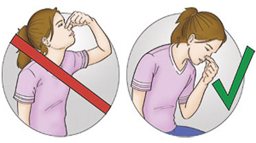 Причины головной боли с кровотечением из носа